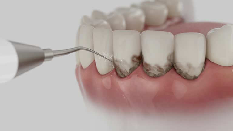 Trusted Tooth Extraction service in Purcell, OK - Dentist Open Now
